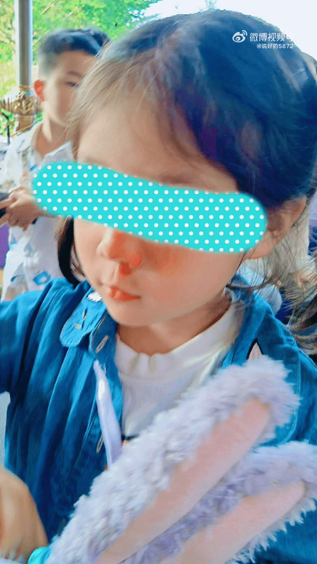 5岁女童在上海迪士尼排队时被插队黄牛撞飞，造成脸部大面积挫伤。网图
