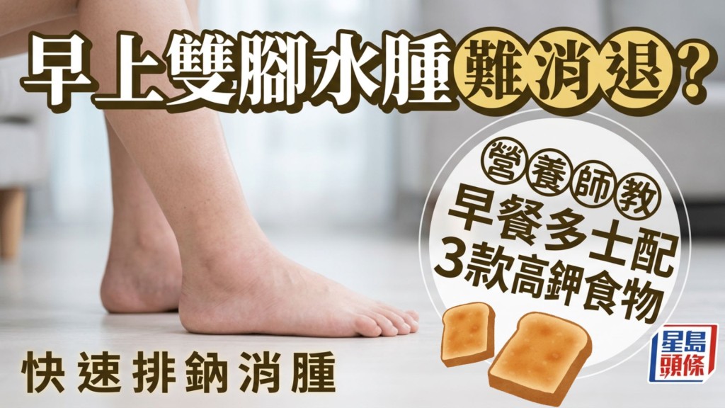早上雙腳水腫難消退？營養師教早餐多士配3款高鉀食物 快速排鈉消腫