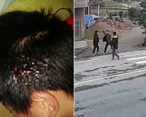 初中生放學路上無故被同學家長追打。