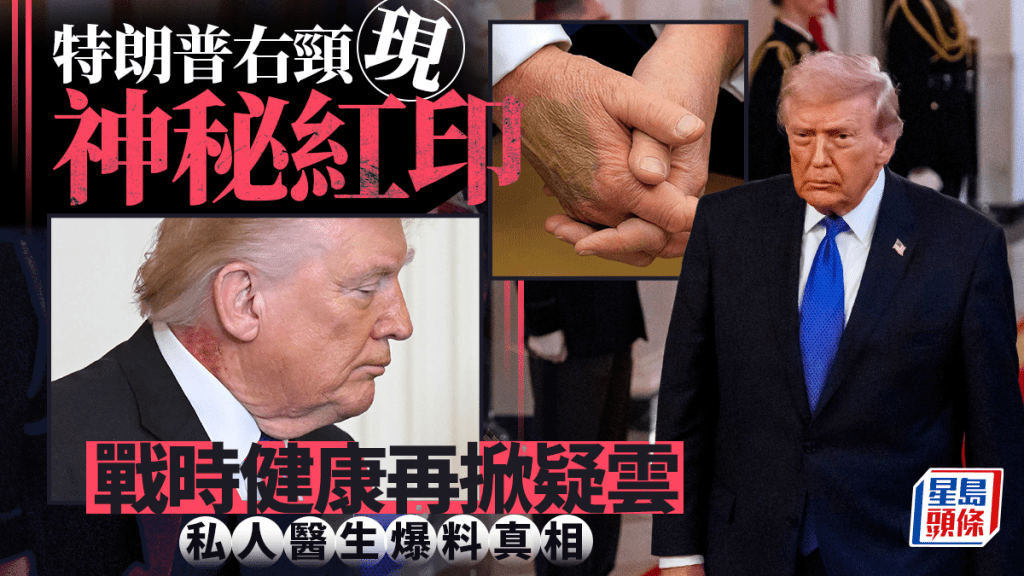 特朗普右頸現紅疹 戰時健康再掀疑雲 白宮御醫爆真相