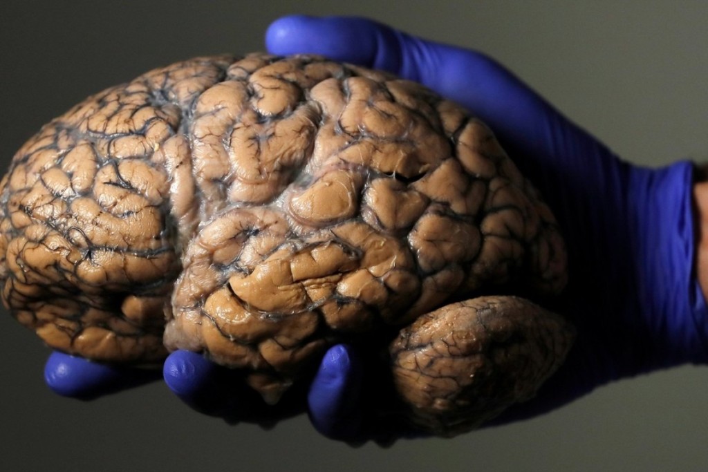 人腦過去數十年平均尺寸增大。路透社