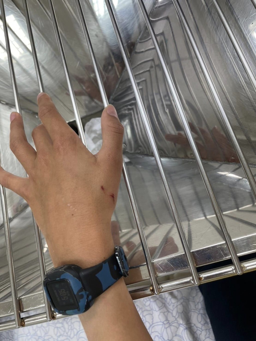 荷兰男童的手部仅受轻伤。（FB@Chiang Mai International Airport-CNX）
