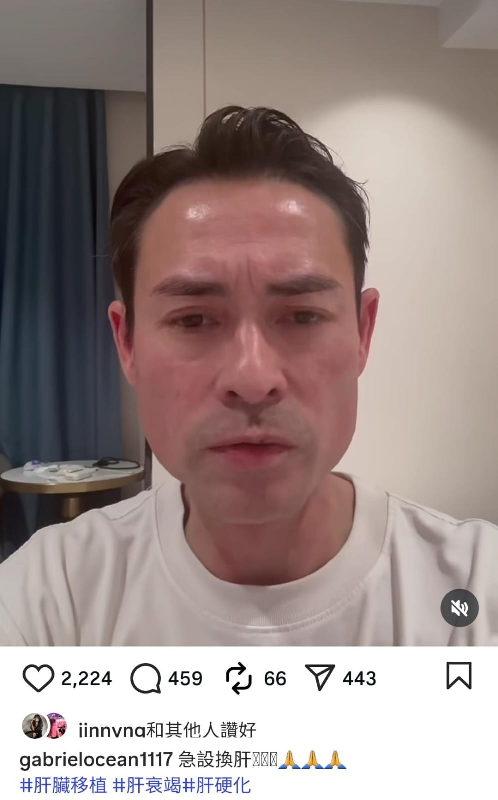 海俊傑去年11月8日在IG開直播，透露太太要「急切換肝」。