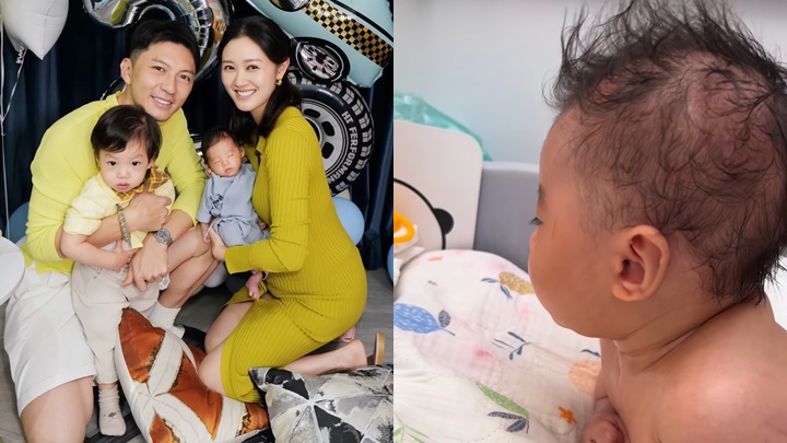 袁偉豪細仔全身「瘀青」嚇窒網民  腋下腰側臀部瘀黑明顯  真相同先天問題有關？