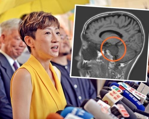 陳淑莊證實患上腦腫瘤,位置壓着腦幹,醫生指要盡快做手術,否則隨時有生命危險。