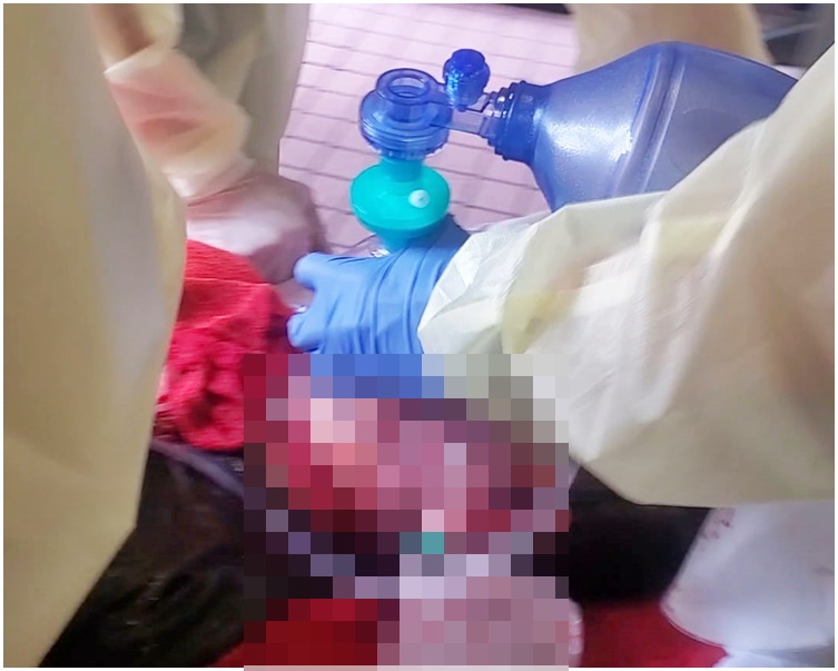 其中一名傷者送院。