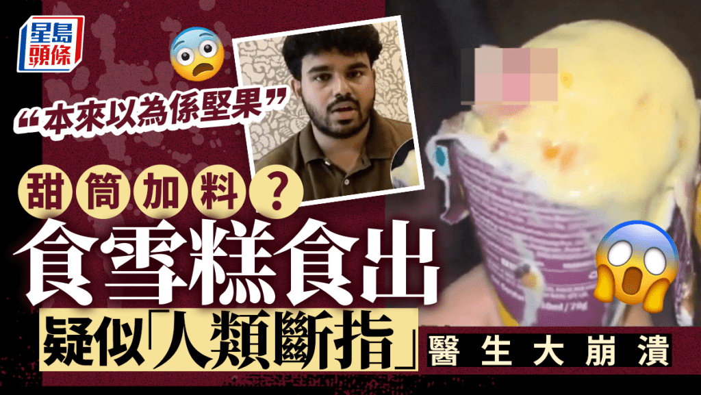 印度醫生食雪糕驚見人類斷指 噁心:以後不敢食甜筒