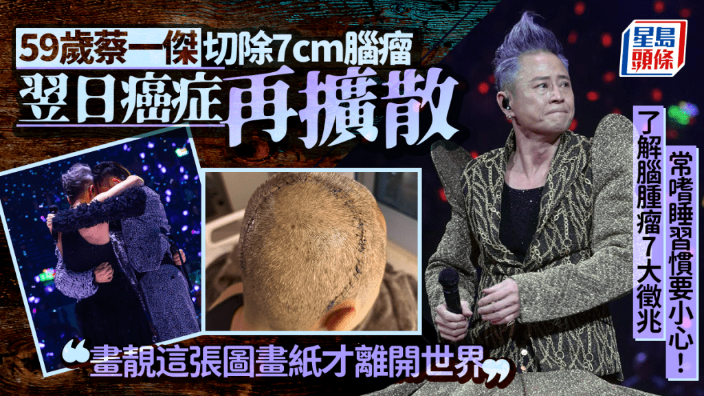 59歲蔡一傑切除7cm腦瘤 翌日癌症再擴散 了解腦腫瘤7大徵兆 常嗜睡習慣要小心！