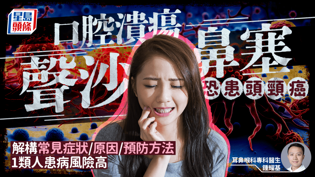 頭頸癌｜聲沙/鼻塞/口腔潰瘍恐患癌 醫生解構常見症狀/原因/預防方法 1類人患病風險高