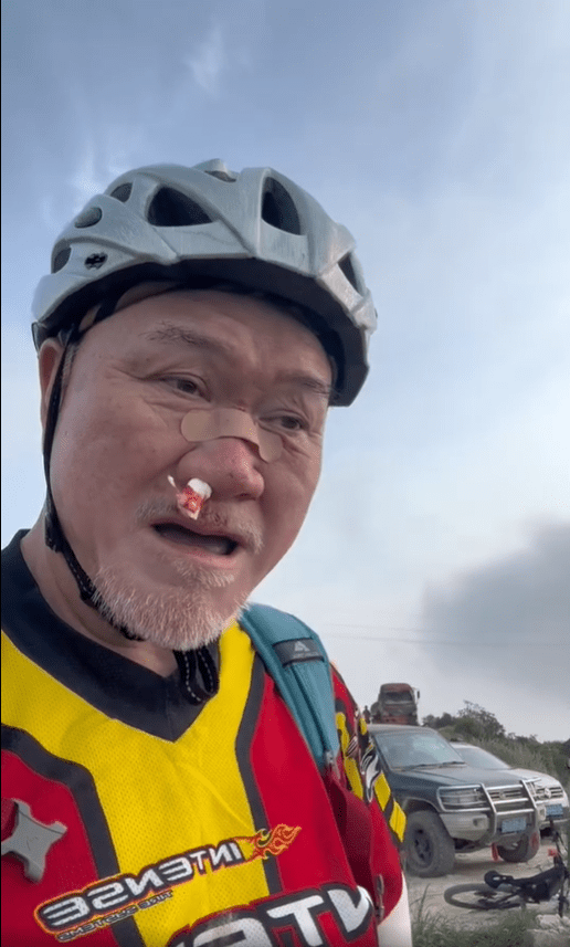 穿上自行车装束的郑恕峰，头戴安全头盔，鼻梁贴上胶布，右边鼻孔塞了一纸渗血的纸巾。