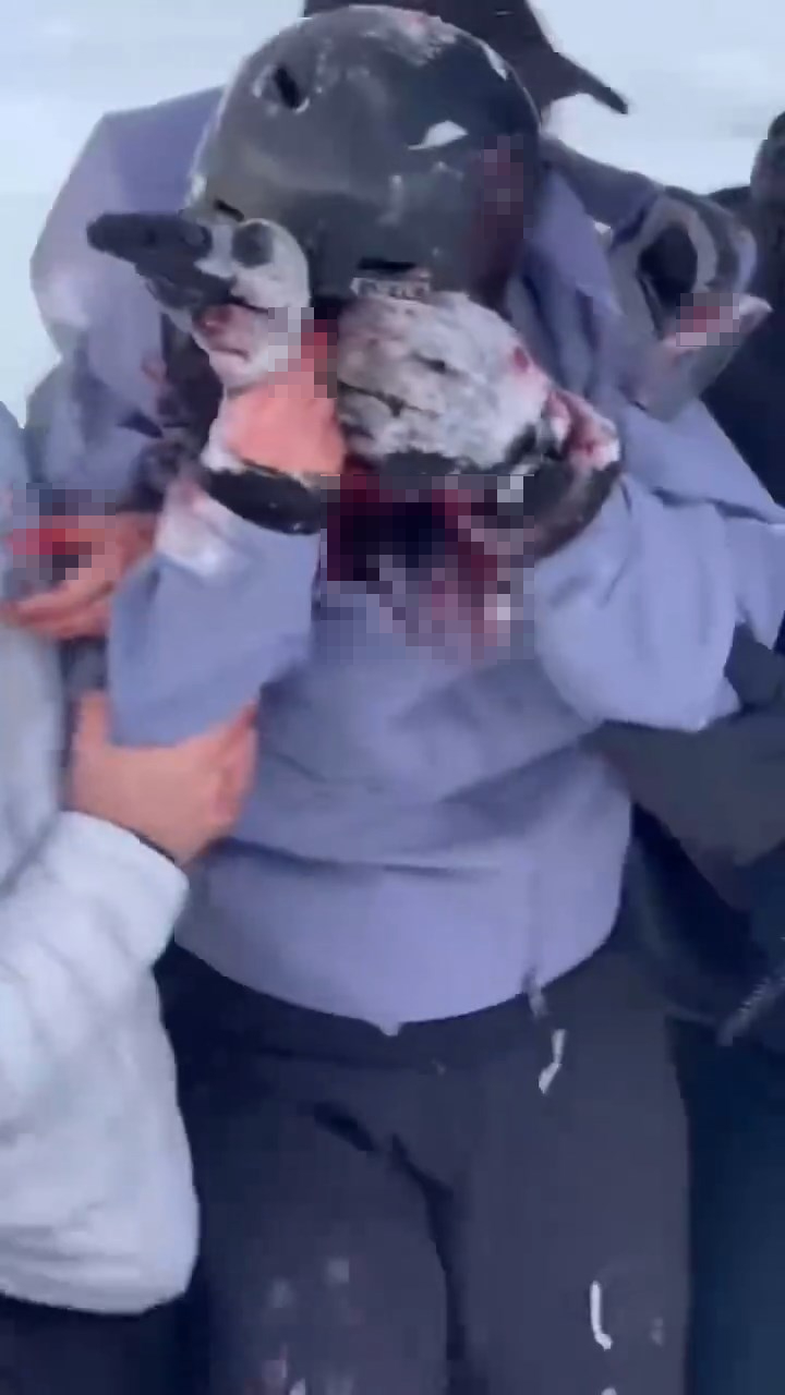 新疆發生雪豹襲擊人類事件。微博@葉安逸