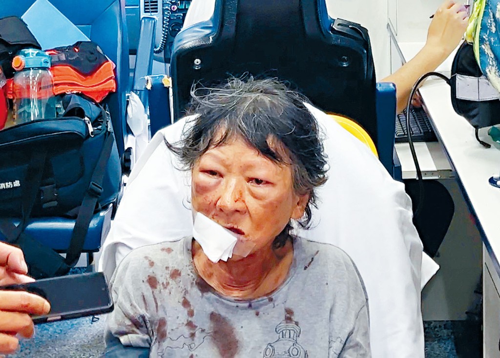 老婦擺地攤期間遇襲，面部及下巴受傷。