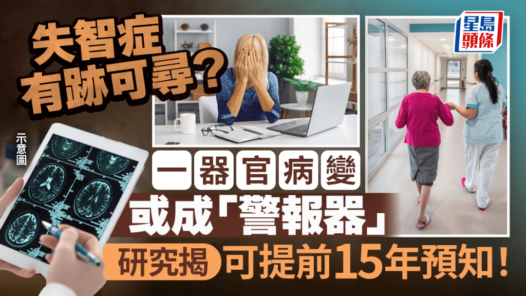 Alamy 示意圖