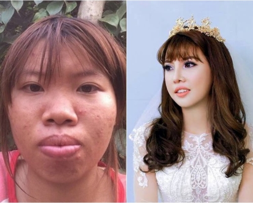 越南女子郭金鳳整容前後判若兩人。網圖