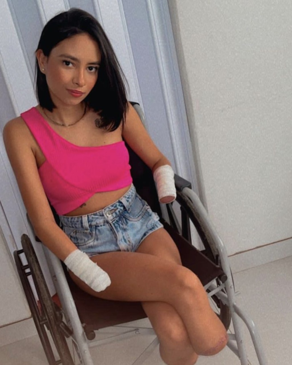 巴尔博萨（Gabrielle Barbosa）因尿道炎转移到肾脏未及时处理，失去四肢。 Instagram@gabi_barbosaa1