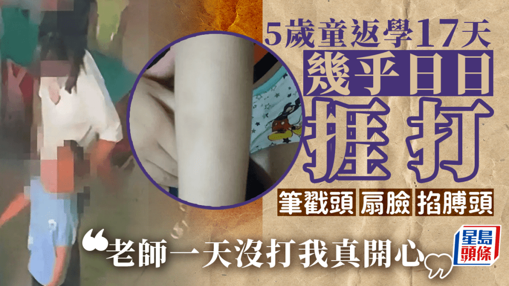 5歲童對母親說了一句：「老師一天沒打我真開心」 ，揭發多名幼師涉虐童。