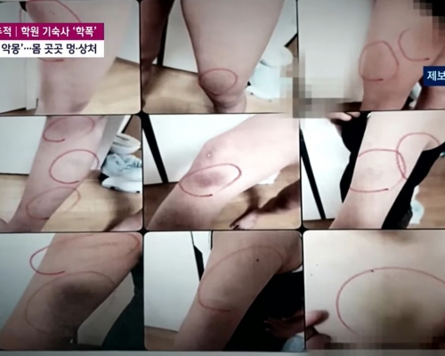 受害女學生身上有多處傷痕。JTBC影片截圖