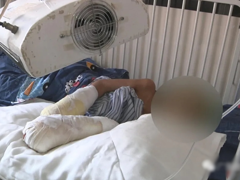 較早前男童被送院時發現全身多處燒傷。網圖