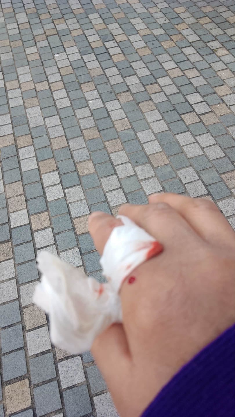 外佣被玻璃碎溅伤。fb「Park Island Friends 珀丽湾快乐群组」图片