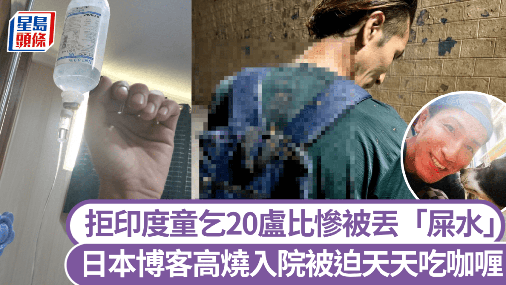 日本博客拒印度童乞討20盧比，被丟「牛糞水球」高燒住院4天。  X@DotabataGG