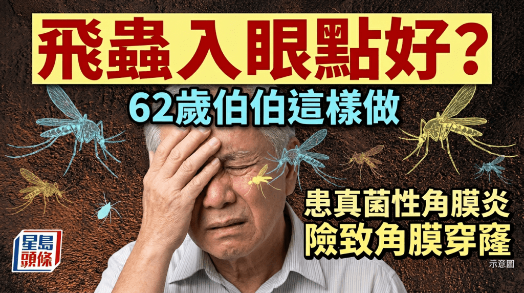 飛蟲入眼點好？  62歲伯伯這樣做  患真菌性角膜炎  險致角膜穿窿