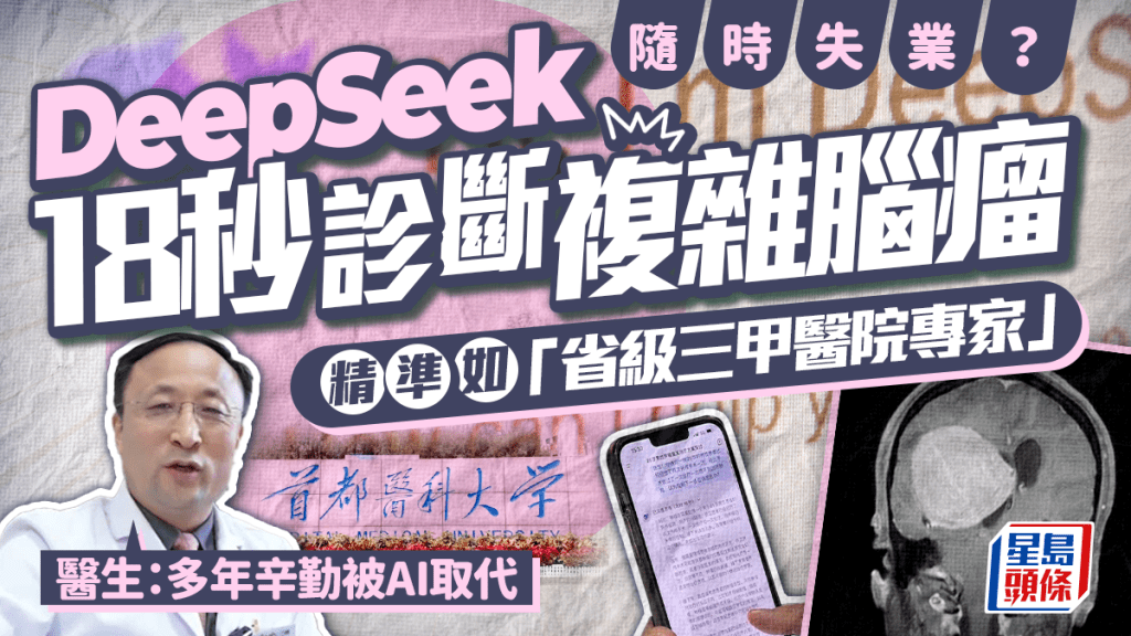 張宏偉利用DeepSeek得到幫助複雜腦瘤患者的治療方案。