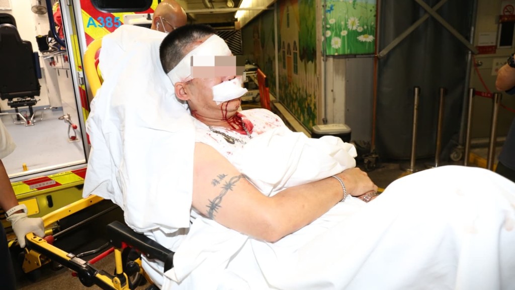 姓黃男事主遭多人施襲，頭部受傷，清醒送院。黎志偉攝