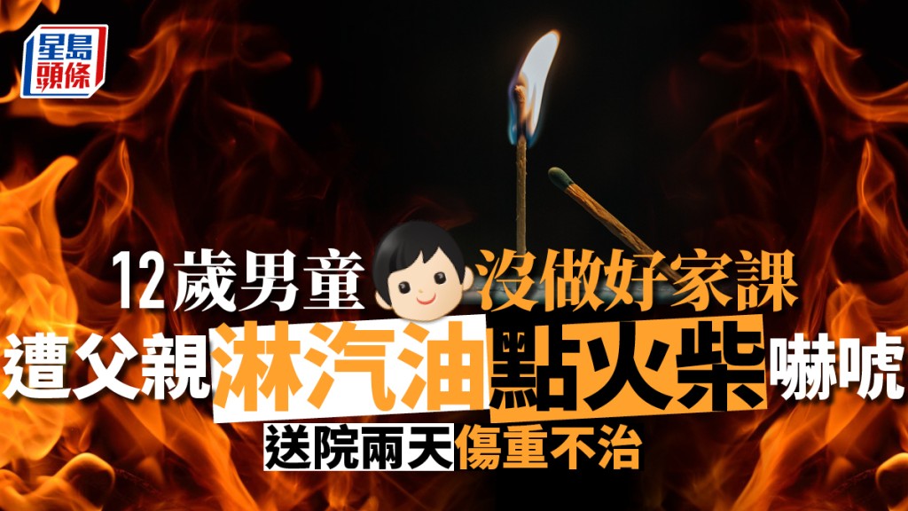 12歲男童因沒好做家課,被父親淋汽油燒死。示意圖