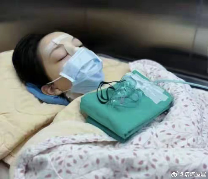 早前在微博疯传疑似从李嫣IG流出的相片，有网民称李嫣第四次接受唇腭裂手术。