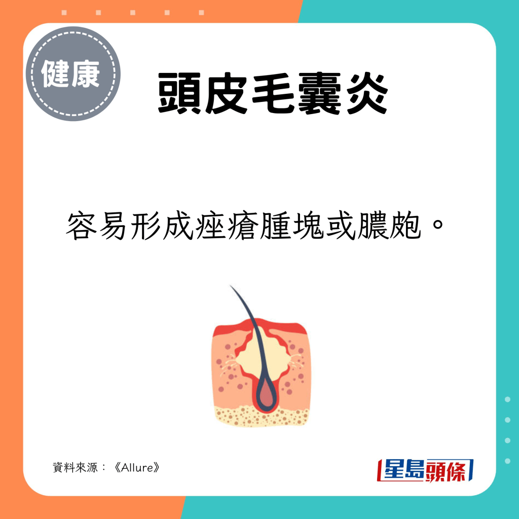 容易形成痤瘡腫塊或膿皰。