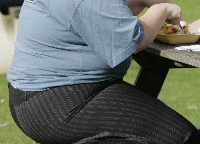 美國癡肥問題嚴重。美聯社
