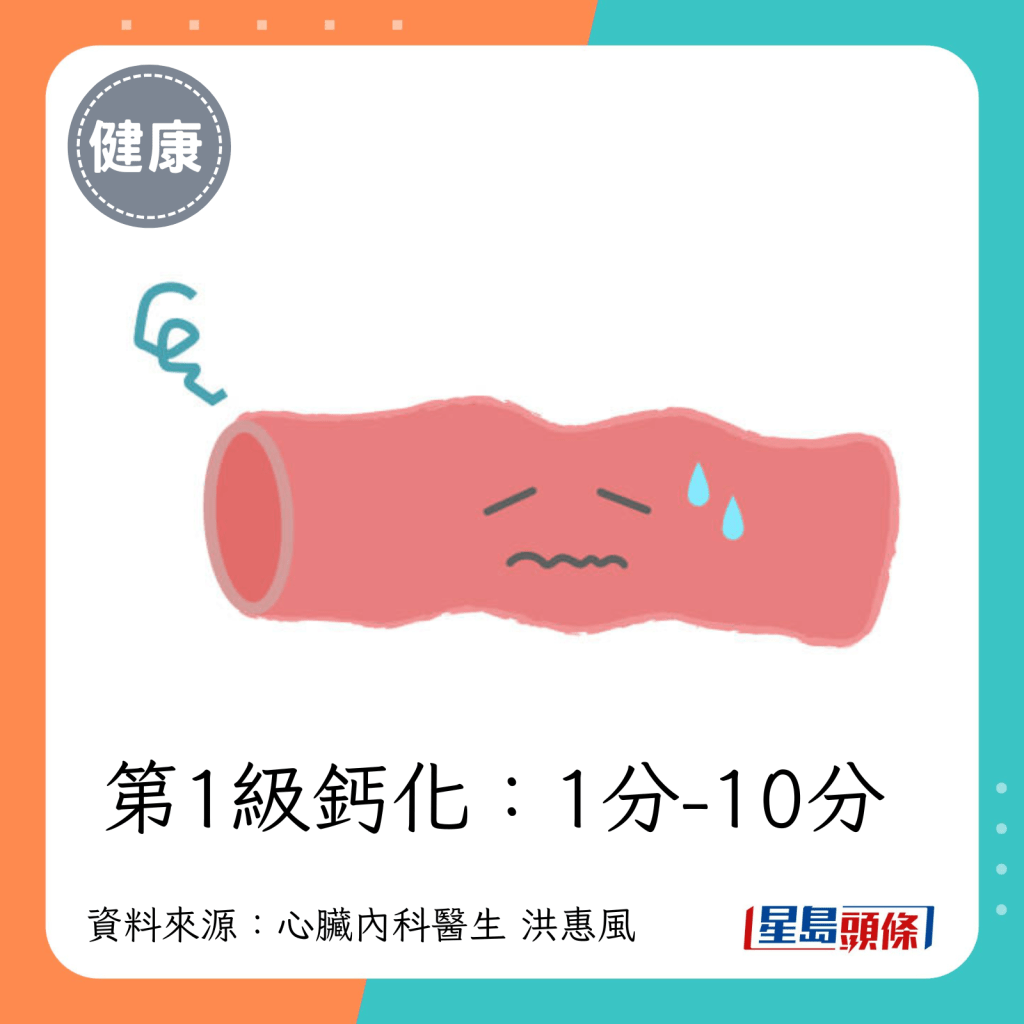 第2级钙化：1分-10分