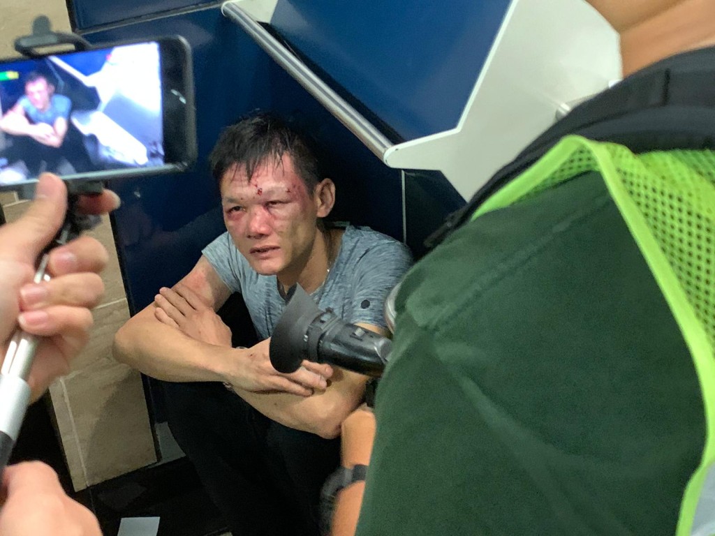 男子被毆致血流披面,坐在一角。