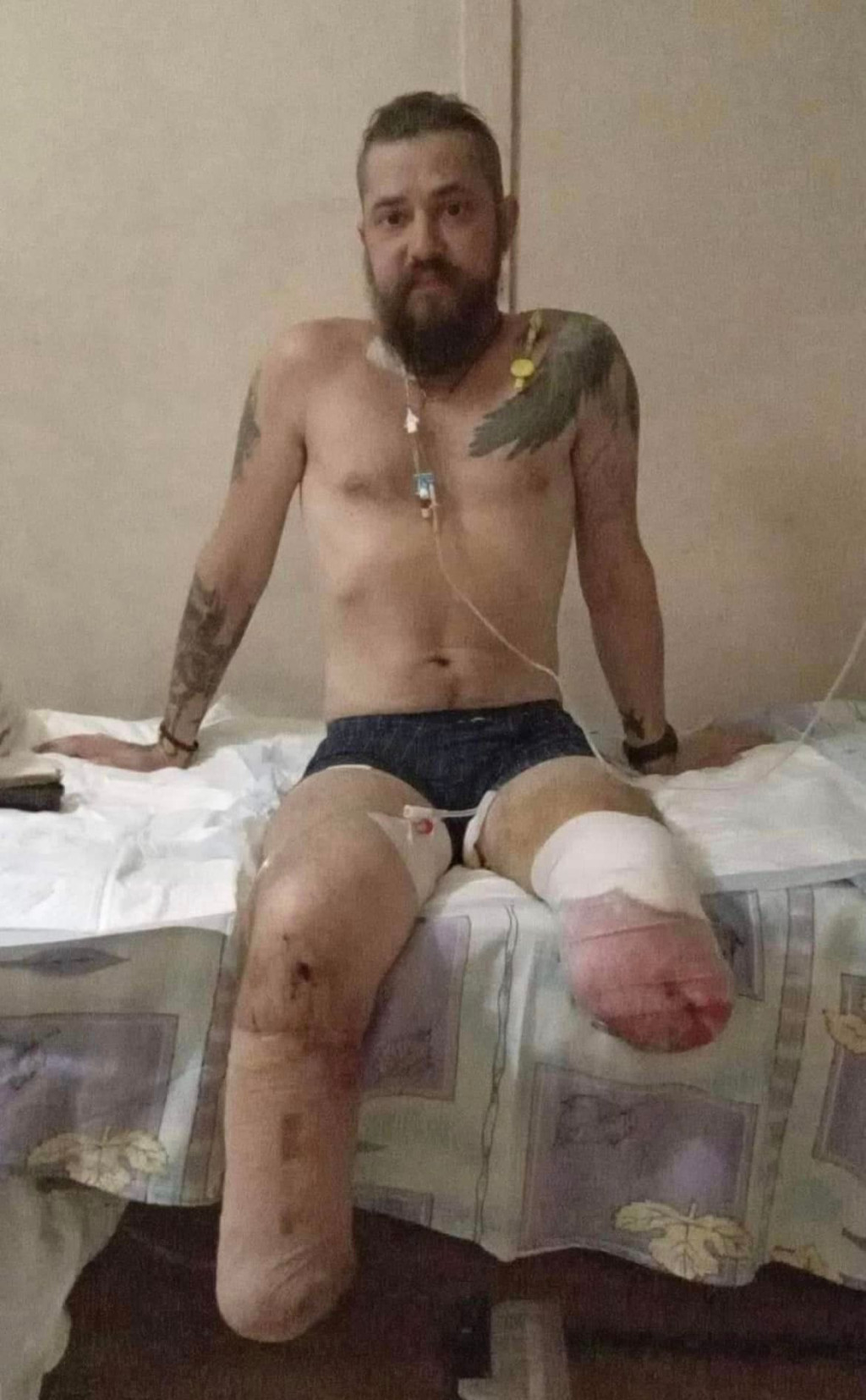 烏克蘭網紅「Tanya」淚曝姊夫雙腳被炸斷。FB圖