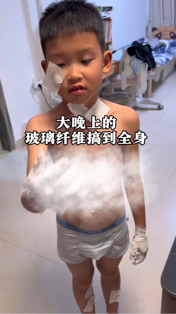 “虫虫”好奇打开灭火毯，致全身刺满玻璃纤维，又痕又痛。抖音