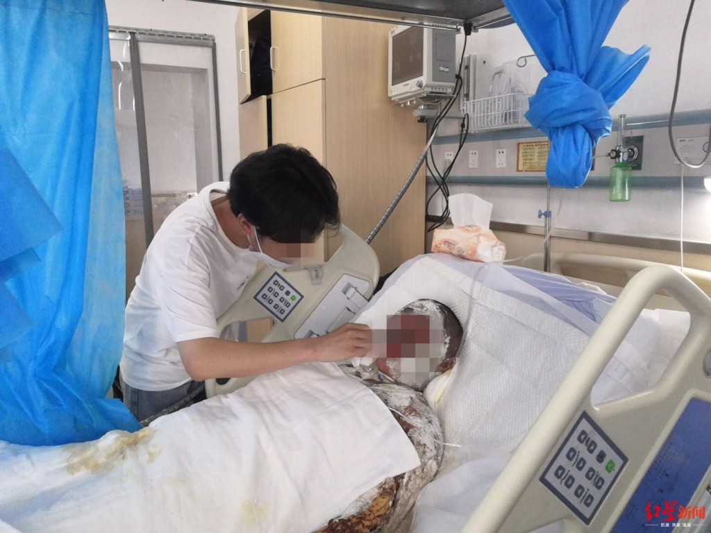 店主夫婦被燒致重傷。網圖