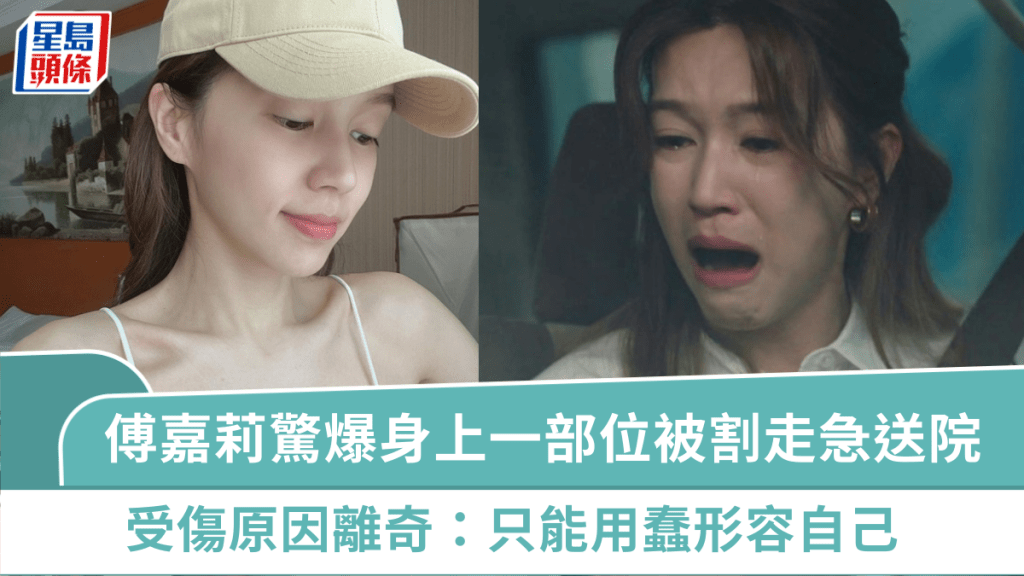 傅嘉莉驚爆身上一部位被割走急送院 受傷原因離奇:只能用蠢形容自己 家人健康亦出事