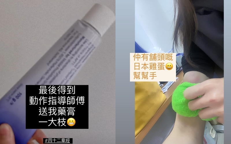 龔嘉欣要搽藥膏及用雞蛋(右圖)散瘀。