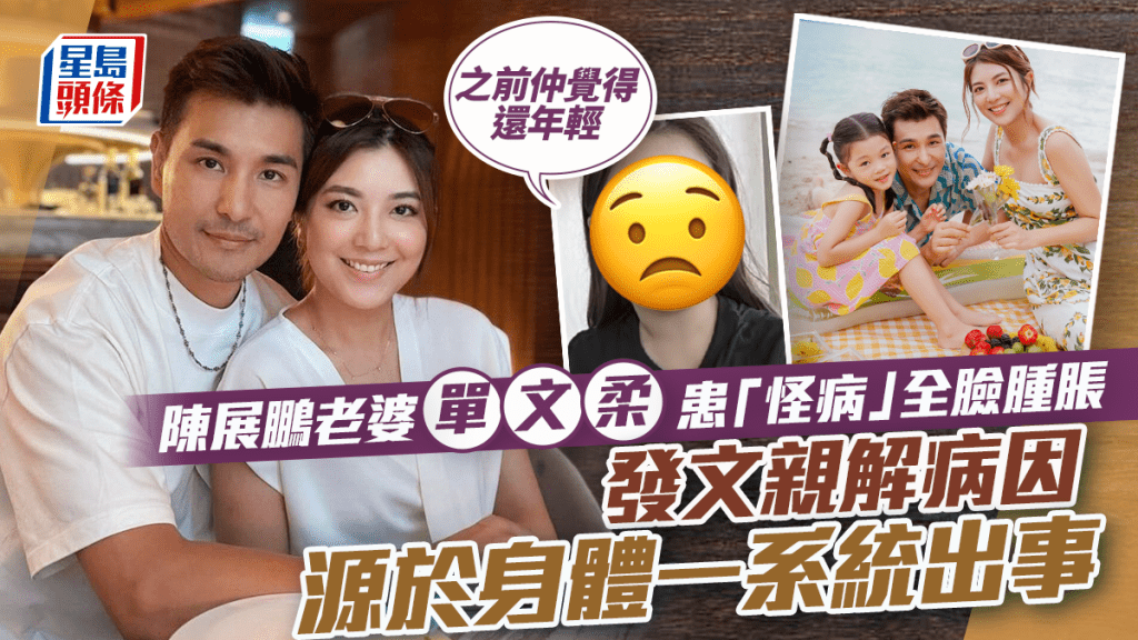 陳展鵬老婆單文柔患「怪病」全臉腫脹  發文親解病因源於身體一系統出事：之前仲覺得還年輕  