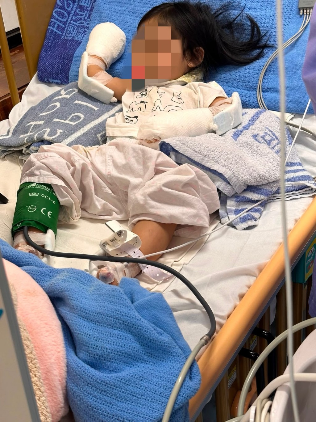 現時女童的雙手傷勢嚴重，需要留院觀察及治療。胡小姐提供