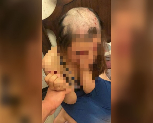 河北女子遭丈夫剃頭被逼承認出軌，警方介入調查。