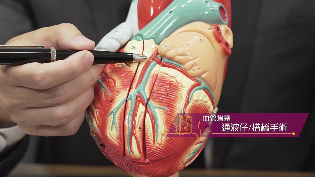 如果是冠狀動脈血管栓塞，可考慮做通波仔或搭橋手術。