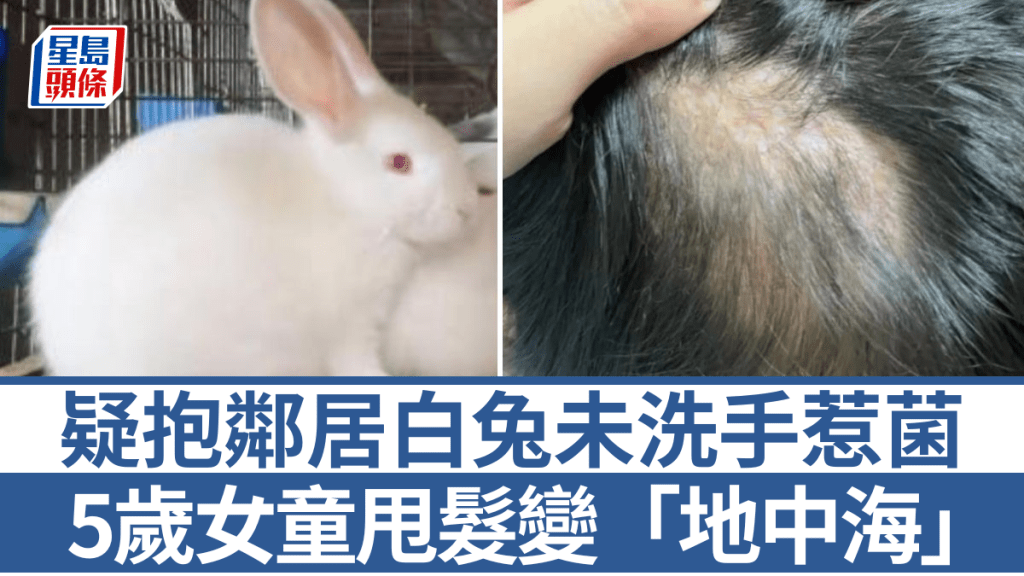 浙江5歲女童愛抱鄰居兔子，頭頂長「膿包」致永久性脫髮。