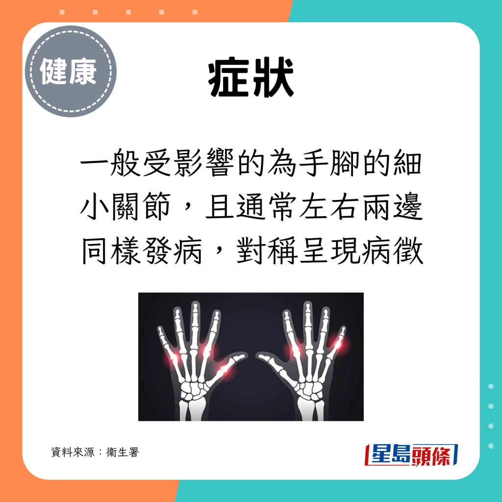 一般受影响的为手脚的细小关节，且通常左右两边同样发病，对称呈现病徵