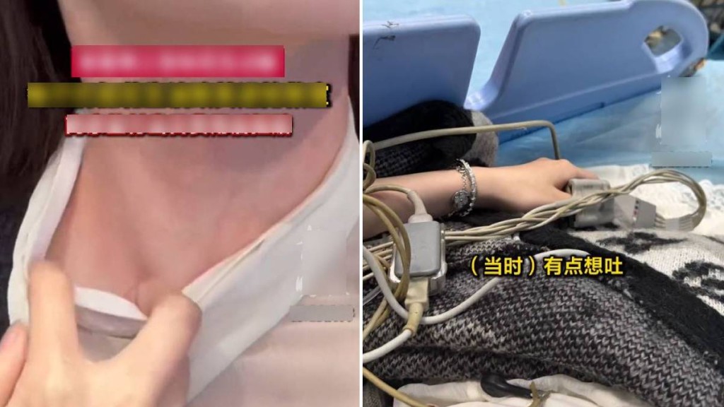 王女士指對花生嚴重過敏，要求涉事飯店賠償千元。揚子晚報