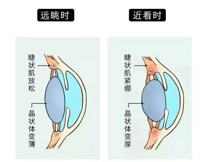 按摩枪或伤害眼球肌肉。（广东省卫生健康委员会）