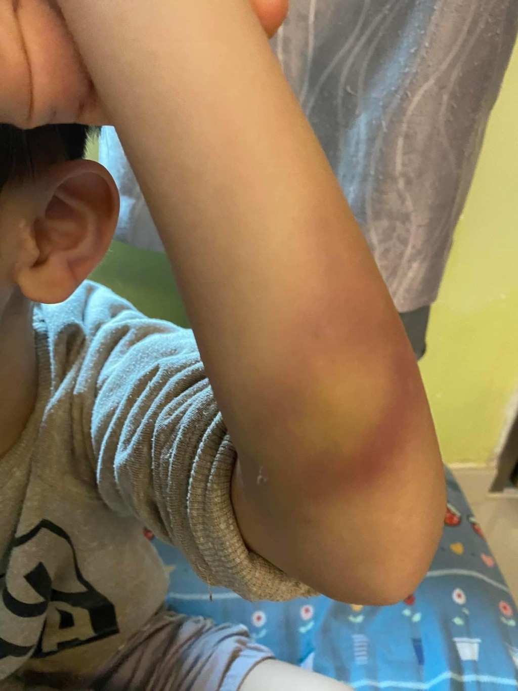 自兒子受傷後，陳媽媽連日來紀錄兒子手傷的康復情況。