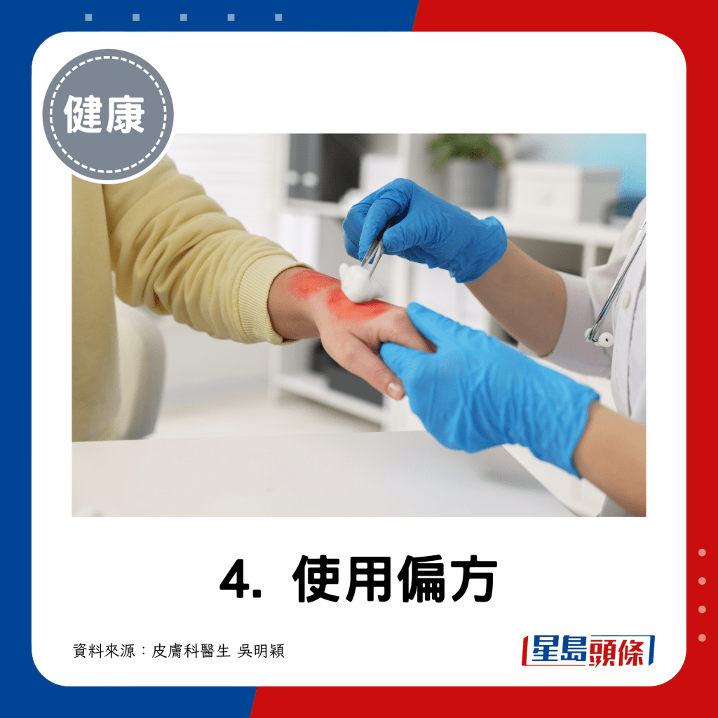 4. 使用偏方