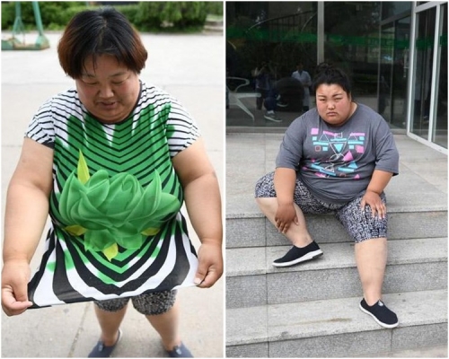 李恆紅(左)指已7年未穿過新衫女兒王麗麗(右)運動一會腳就痛。
