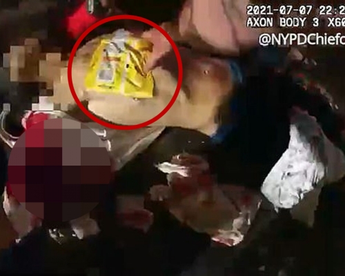 紐約男遭刀刺血流不止， 警員拿薯片袋止血救命。